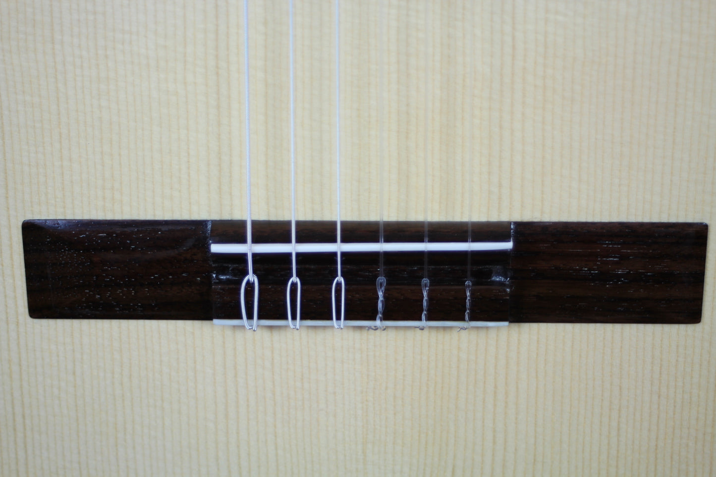 Milestones - Torres Model