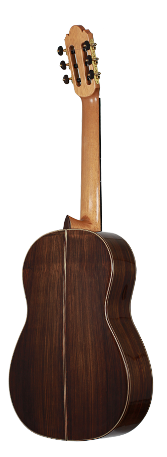 Milestones - Torres Model