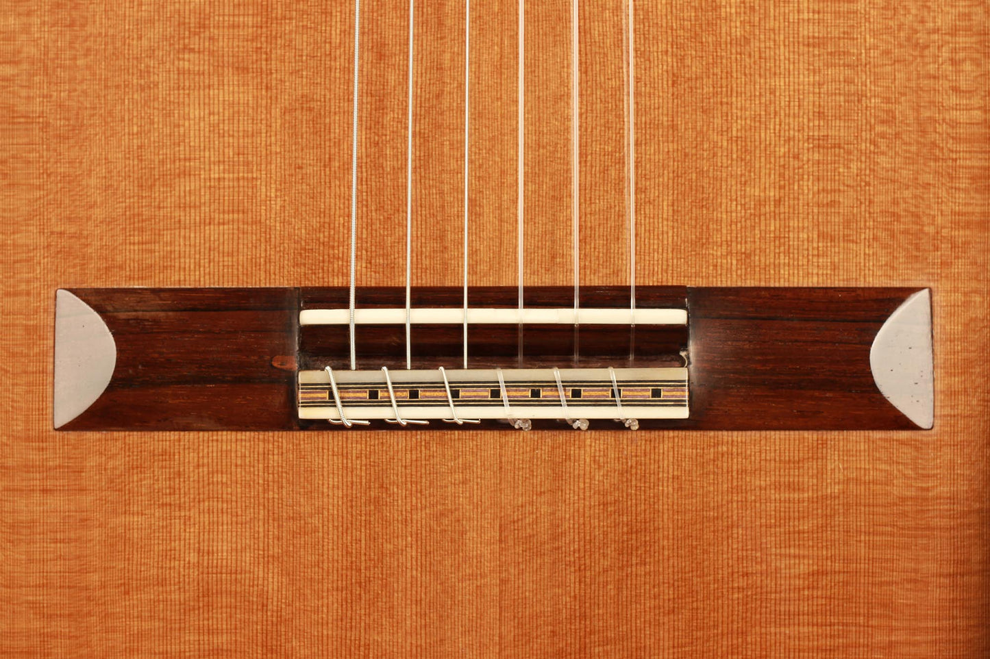 Glenn D. Canin - 2015 Doubletop