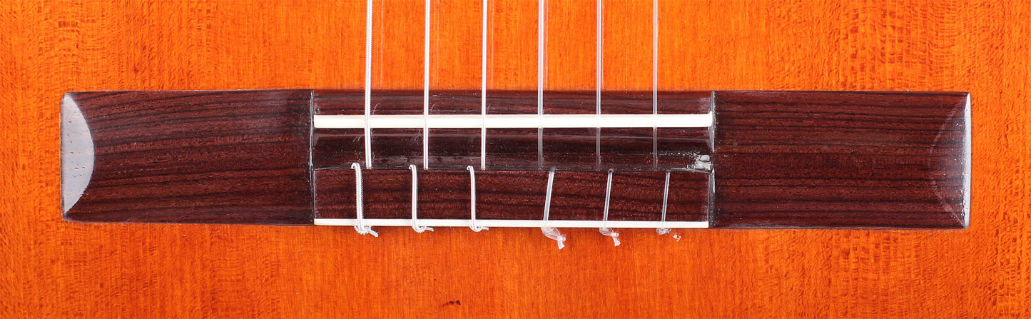 Milestones - Torres Model Relic