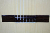 Milestones - Torres Model