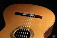 José González López - 2025 Cedar - Madagascar rosew. No.317 64 cm