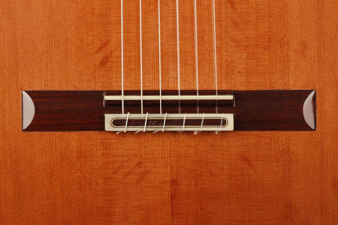 Antonius Müller - 2011 Doubletop