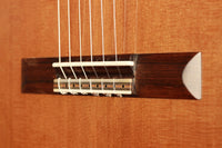 Glenn D. Canin - 2015 Doubletop
