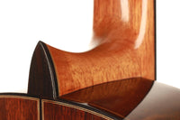 Glenn D. Canin - 2015 Doubletop