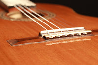 Glenn D. Canin - 2015 Doubletop