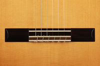 Stefan Zander - 2015 Doubletop