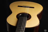 Dennis Tolz - 2025 No. 73 Doubletop
