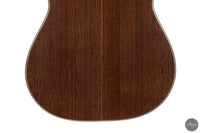 Jialan Chen - 2026 Coclea Thucea "Fibonacci"