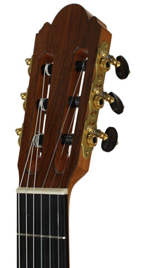 Milestones - Torres Model