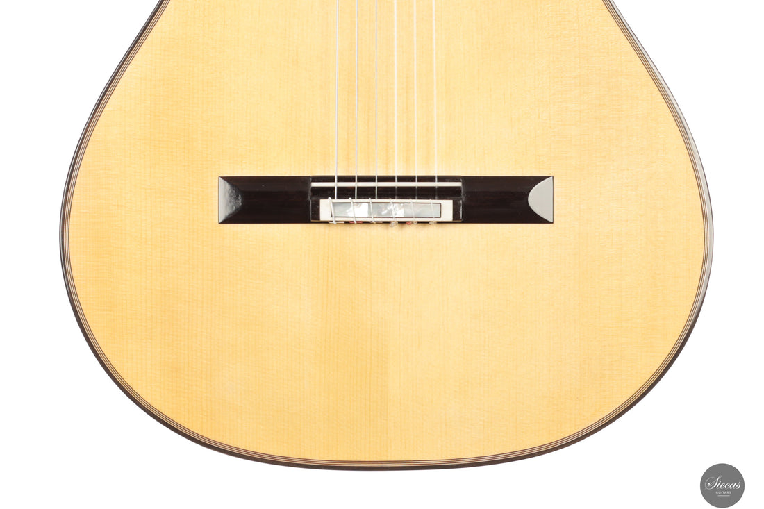 Siccas Luthiers - Synthesis Doubletop Spruce